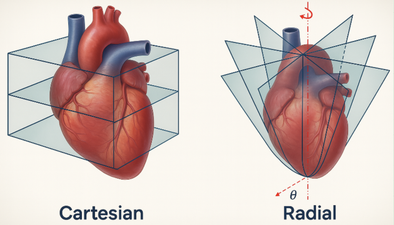 Radial Resampling